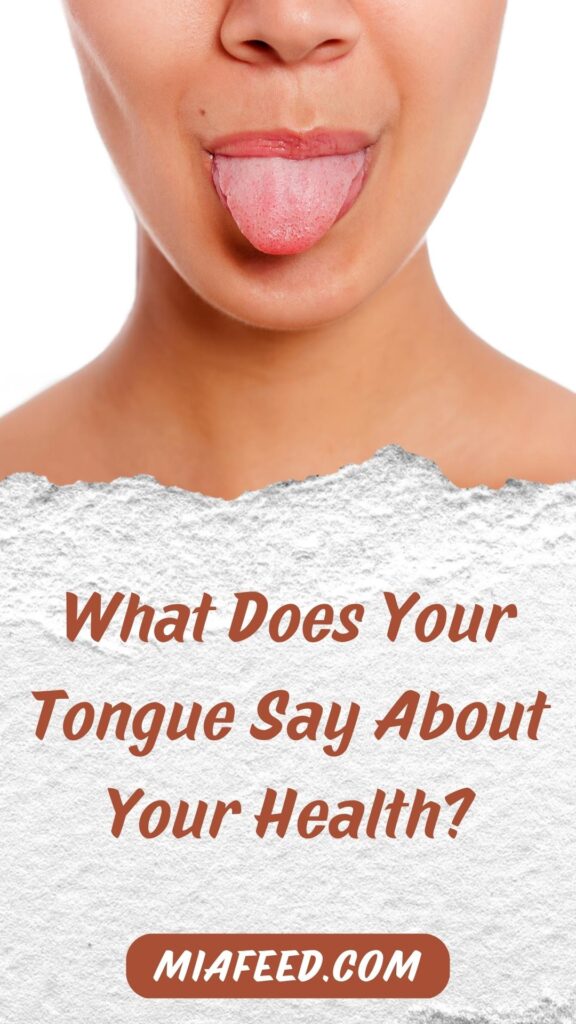 What Does Your Tongue Say About Your Health - MIA FEED